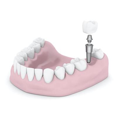 hampton dentist