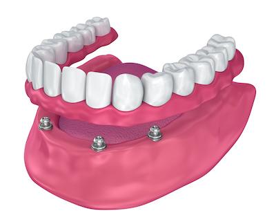 dentist near me
