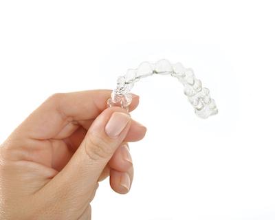 Invisalign in fairfield
