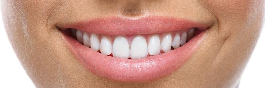 Woman with white teeth in Hampton East