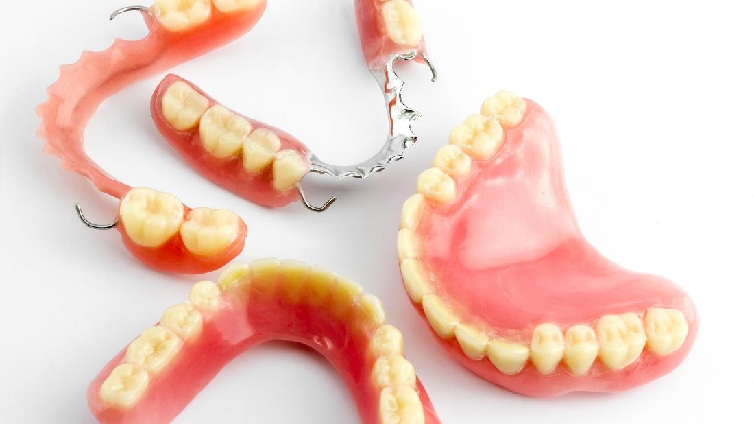Smile More with ImplantRetained Dentures Sparkle Dental Care Blog