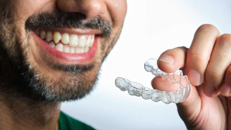 Invisalign braces in fairfield