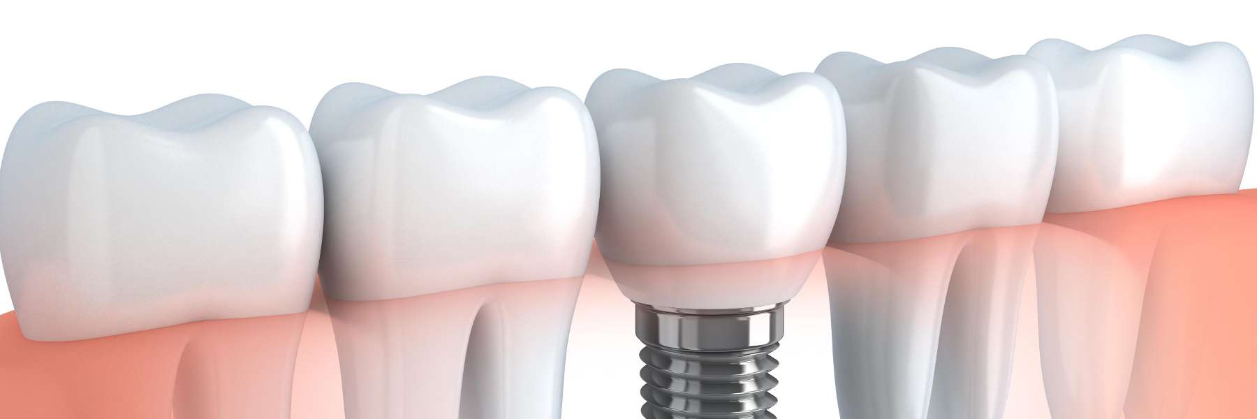 cosmetic dentist hampton