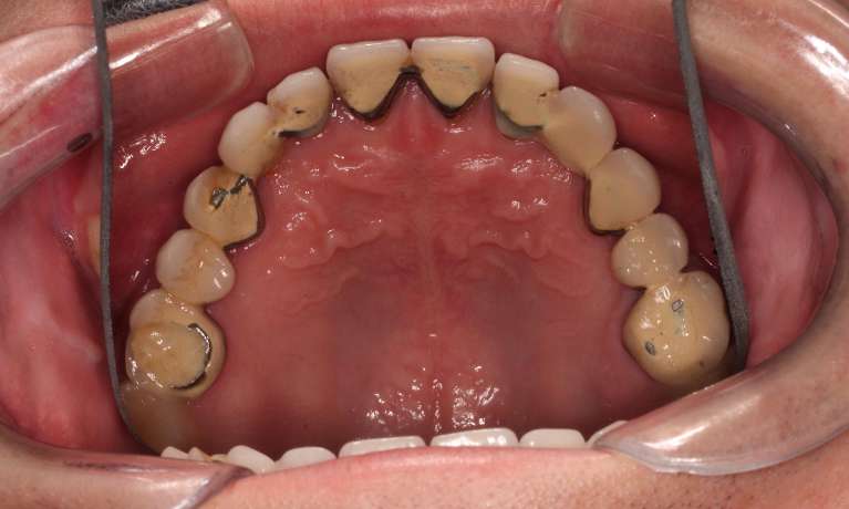 cosmetic dentistry hampton vic